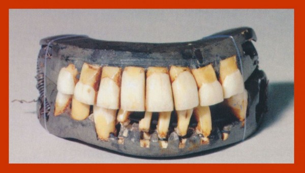 teethanddentures2 - Boo Trundle
